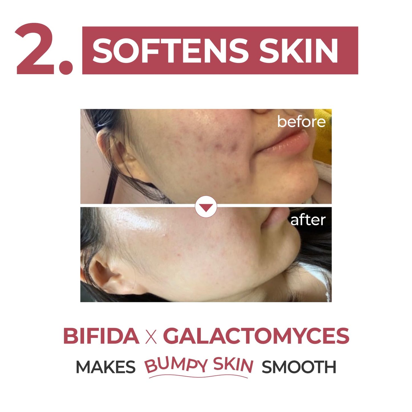 Numbuzin – No.3 Skin Softening Serum 50ml